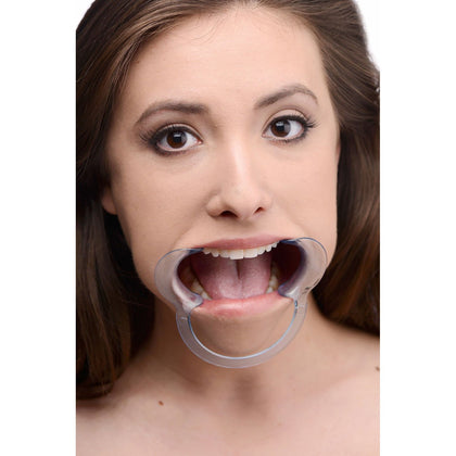 Cheek Retractor